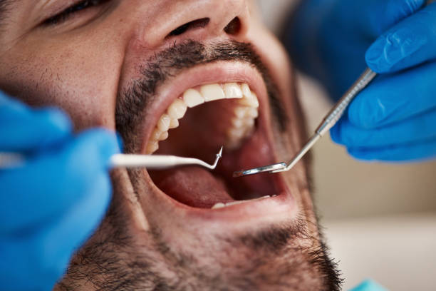 Best Emergency Treatment for Toothache in Franklin, KY